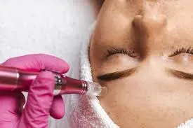 Dermapen service image