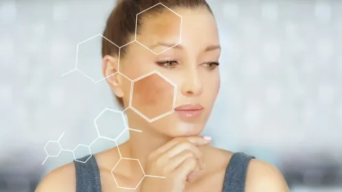 Melasma Treatments service image