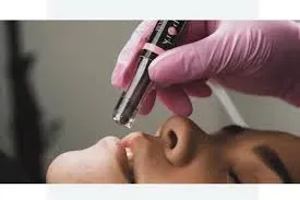 Hydrafacial Lip Perk service image