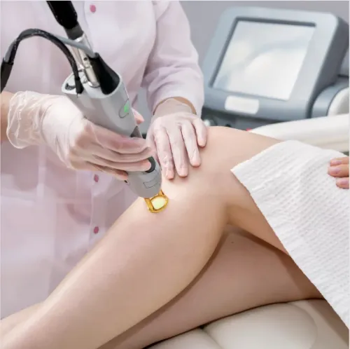 LASER HAIR REMOVAL service image