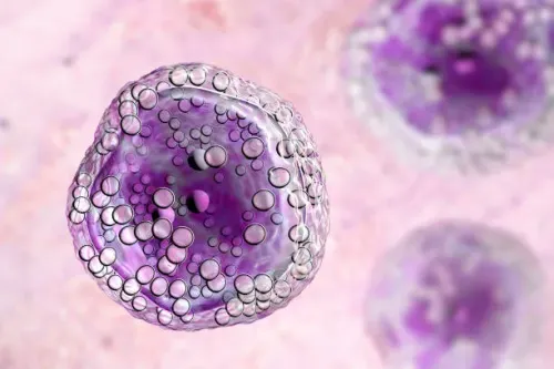 Treatment of Lymphoma product image