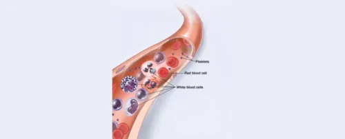 Acute Leukemia product image