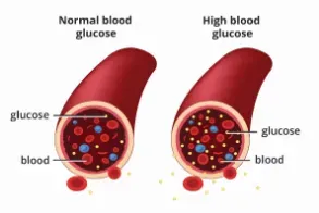 Diabetes Mellitus Treatment in Pune service image