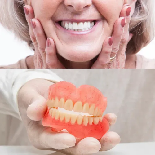 Dentures service image