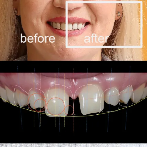 Cosmetic Dentistry service image