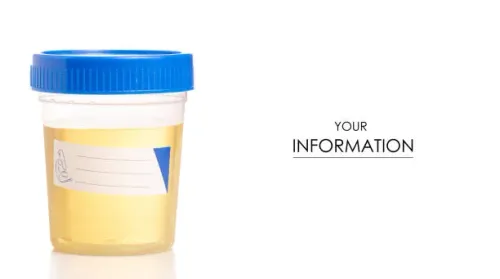 URINE-RM service image