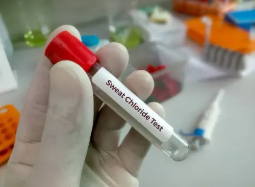 CHLORIDE service image