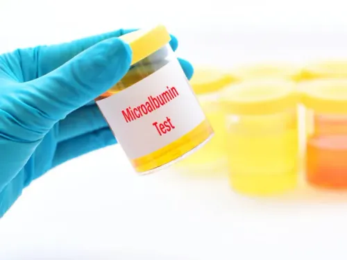 URINE MICROALBUMIN service image