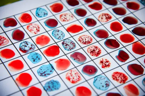 Protien/Albumnin/Globulin test service image