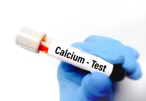 Calcium test service image