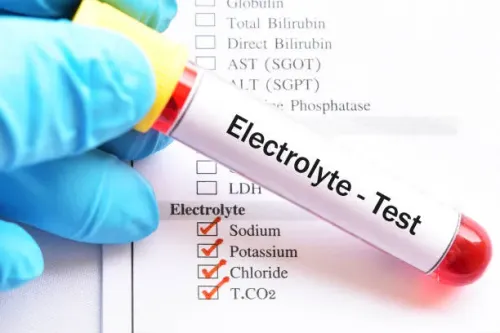 ELECTROLYTES  service image