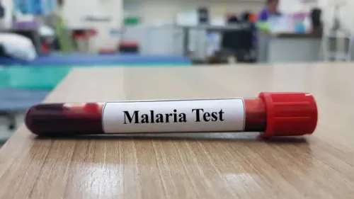 Malaria Antigen Test service image