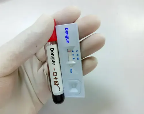 DENGUE (IGM & IGG) service image