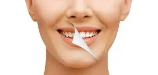 Smile Makeover service image