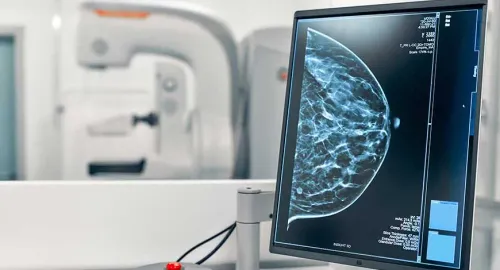 Advanced Mammography service image