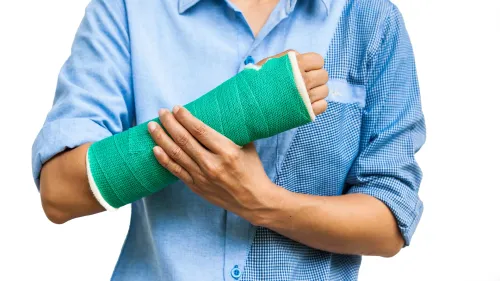 Treatment of Fractures service image