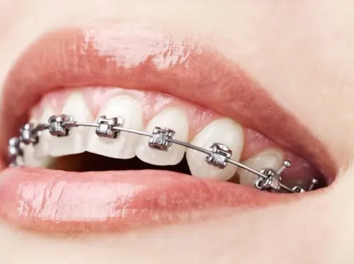  Orthodontic Treatments service image