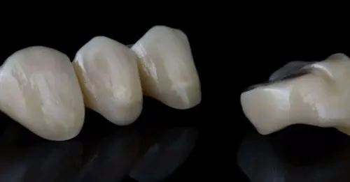 Prosthodontic  Treatments service image