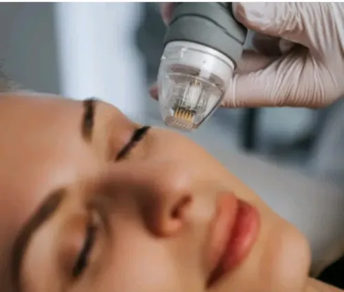  Microneedling RF service image
