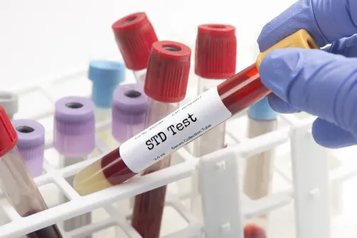 STD TESTING service image