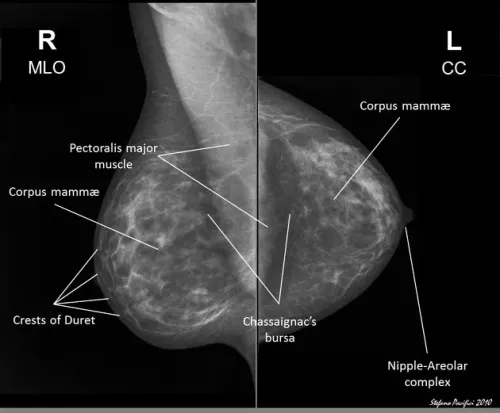 MAMMOGRAMS product image