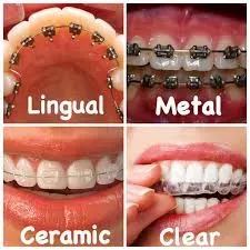 Orthodontic Treatment service image