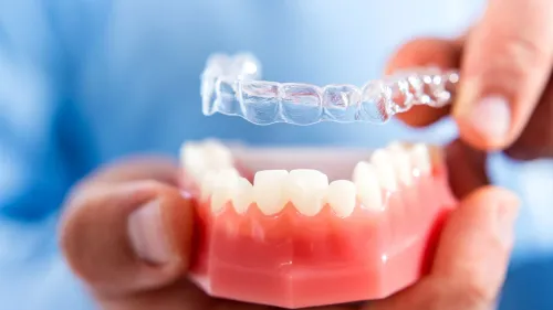 Invisible and Clear Aligners Treatment service image