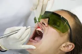 Gum Surgery service image