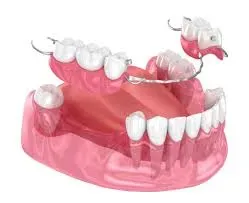 Dentures service image