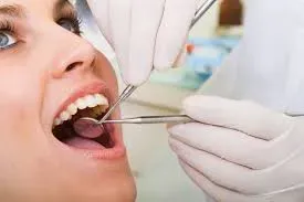 Dental Checkup service image