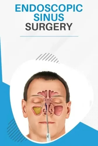Endoscopic Sinus Surgery service image
