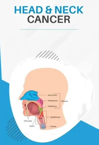 Head and Neck Cancer service image