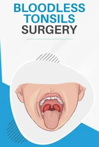 Bloodless Tonsils Surgery service image