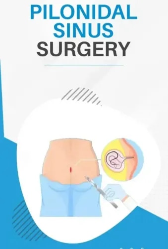 Pilonidal Sinus Surgery service image