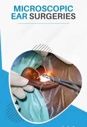 Microscopic Ear Surgeries service image