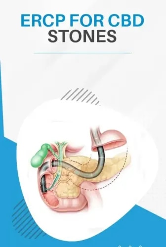 ERCP (Endoscopic Retrograde Cholangio-Pancreatography) service image
