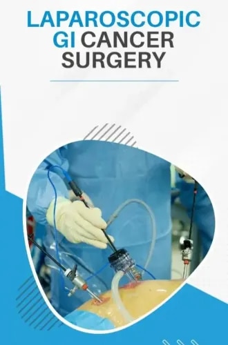 Laparoscopic GI Cancer Surgery  service image