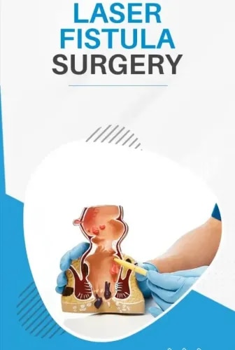 Laser Fistula Surgery service image