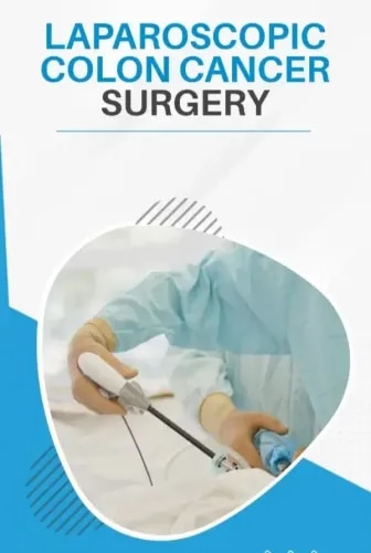 Laparoscopic Colon Cancer Surgery service image