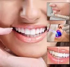 Dental Treatments  service image