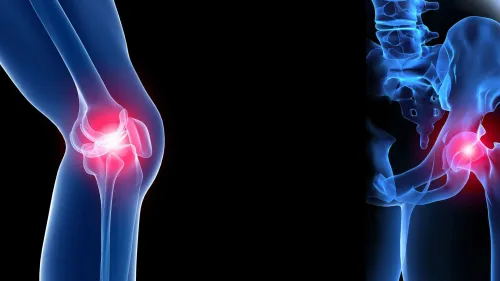 Knee Replacement  service image