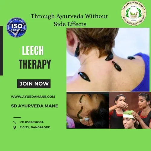 Leech Therapy service image