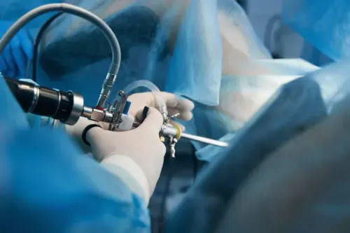 Laparoscopic Surgery product image