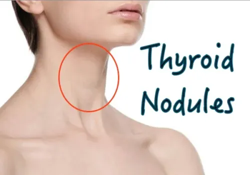 Thyroid Doctor in Viman Nagar, Kharadi, Vishrantwadi, Pune service image