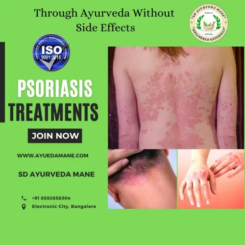 Psoriasis Relief Therapy service image