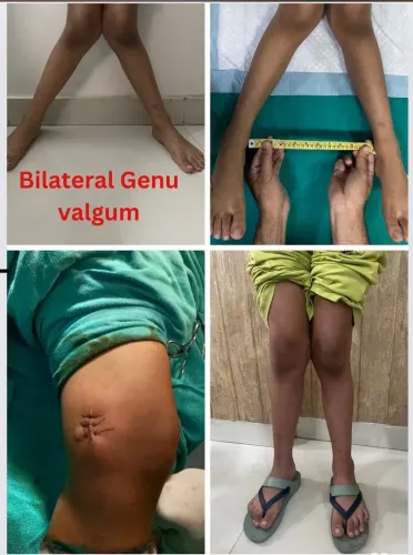 Deformity correction service image