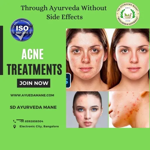 Acne Therapy service image
