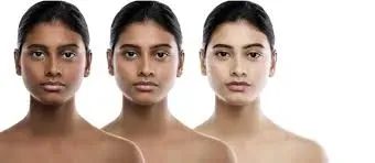 Body whitening Treatment service image