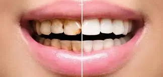 Restorative Dentistry service image