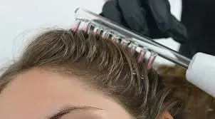 Hair High Frequency Treatment service image